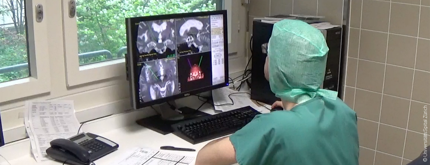 gehirnstimulation