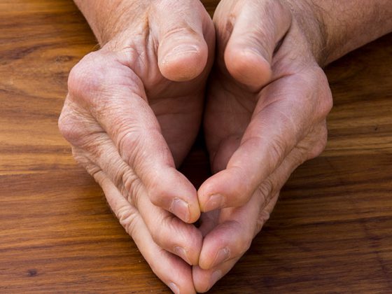 psoriasis-arthritis_istock-1333218137