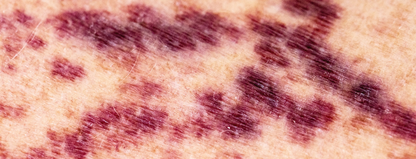 istock-639952822