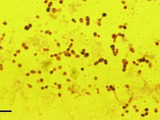 Pneumococcus