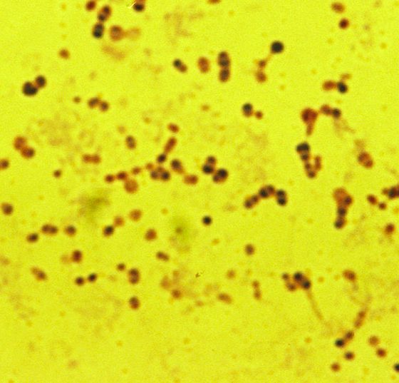 Pneumococcus