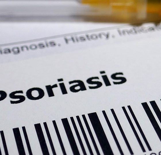 psoriasis_istock-1128839115