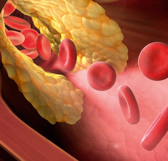 arterie_blut